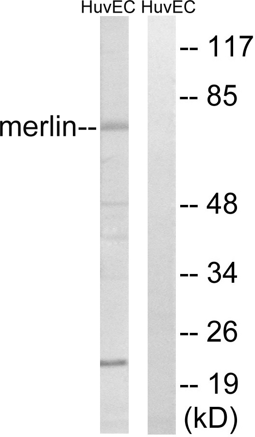 NF2 / Merlin Antibody - Western blot analysis of lysates from HUVEC cells, treated with IFN-Î± 1000U/ml 18h, using Merlin Antibody. The lane on the right is blocked with the synthesized peptide.