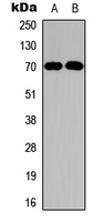 NF2 / Merlin Antibody - Western blot analysis of Merlin expression in HepG2 (A); MCF7 (B) whole cell lysates.