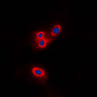 NF2 / Merlin Antibody - Immunofluorescent analysis of Merlin staining in MCF7 cells. Formalin-fixed cells were permeabilized with 0.1% Triton X-100 in TBS for 5-10 minutes and blocked with 3% BSA-PBS for 30 minutes at room temperature. Cells were probed with the primary antibody in 3% BSA-PBS and incubated overnight at 4 deg C in a humidified chamber. Cells were washed with PBST and incubated with a DyLight 594-conjugated secondary antibody (red) in PBS at room temperature in the dark. DAPI was used to stain the cell nuclei (blue).