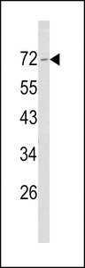 NF2 / Merlin Antibody - Western blot of Merlin Antibody in NCI-H460 cell line lysates (35 ug/lane). NF2 (arrow) was detected using the purified antibody.