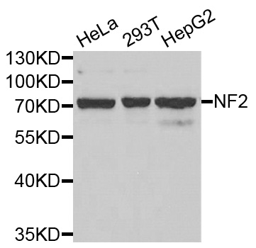 NF2 / Merlin Antibody - Western blot analysis of extracts of various cell lines, using NF2 antibody.