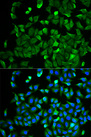 NF2 / Merlin Antibody - Immunofluorescence analysis of HeLa cell using NF2 antibody. Blue: DAPI for nuclear staining.