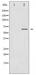 NF2 / Merlin Antibody - Western blot of Merlin expression in IFN- alpha treated HUVEC whole cell lysates,The lane on the left is treated with the antigen-specific peptide.