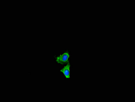 NF2 / Merlin Antibody - Immunofluorescent analysis of Hela cells using NF2 Antibody at a dilution of 1:100 and Alexa Fluor 488-congugated AffiniPure Goat Anti-Rabbit IgG(H+L)