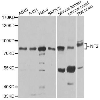 NF2 / Merlin Antibody - Western blot analysis of extracts of various cell lines, using NF2 antibody at 1:1000 dilution. The secondary antibody used was an HRP Goat Anti-Rabbit IgG (H+L) at 1:10000 dilution. Lysates were loaded 25ug per lane and 3% nonfat dry milk in TBST was used for blocking. An ECL Kit was used for detection and the exposure time was 60s.
