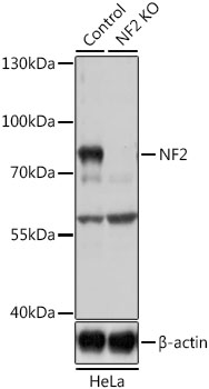 NF2 / Merlin Antibody - Western blot analysis of extracts from normal (control) and NF2 knockout (KO) HeLa cells, using NF2 antibody at 1:1000 dilution. The secondary antibody used was an HRP Goat Anti-Rabbit IgG (H+L) at 1:10000 dilution. Lysates were loaded 25ug per lane and 3% nonfat dry milk in TBST was used for blocking. An ECL Kit was used for detection and the exposure time was 6s.