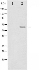 NF2 / Merlin Antibody - Western blot analysis of Merlin expression in IFN-a treated HuvEc whole cells lysates. The lane on the left is treated with the antigen-specific peptide.