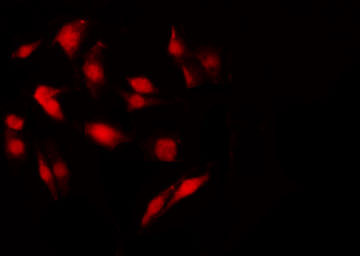 NF2 / Merlin Antibody - Staining NIH-3T3 cells by IF/ICC. The samples were fixed with PFA and permeabilized in 0.1% Triton X-100, then blocked in 10% serum for 45 min at 25°C. The primary antibody was diluted at 1:200 and incubated with the sample for 1 hour at 37°C. An Alexa Fluor 594 conjugated goat anti-rabbit IgG (H+L) Ab, diluted at 1/600, was used as the secondary antibody.