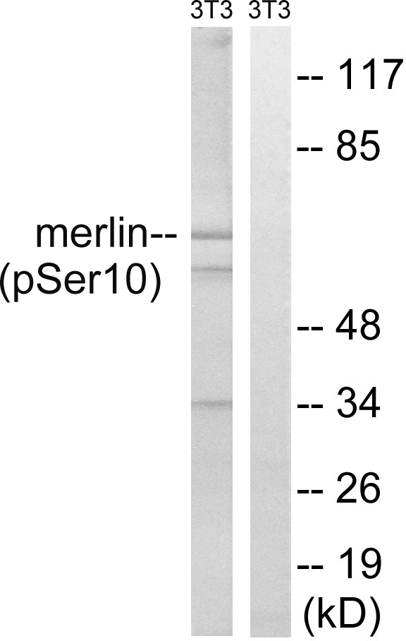 NF2 / Merlin Antibody - Western blot analysis of lysates from NIH/3T3 cells treated with IFN 2500U/ml 30', using Merlin (Phospho-Ser10) Antibody. The lane on the right is blocked with the phospho peptide.