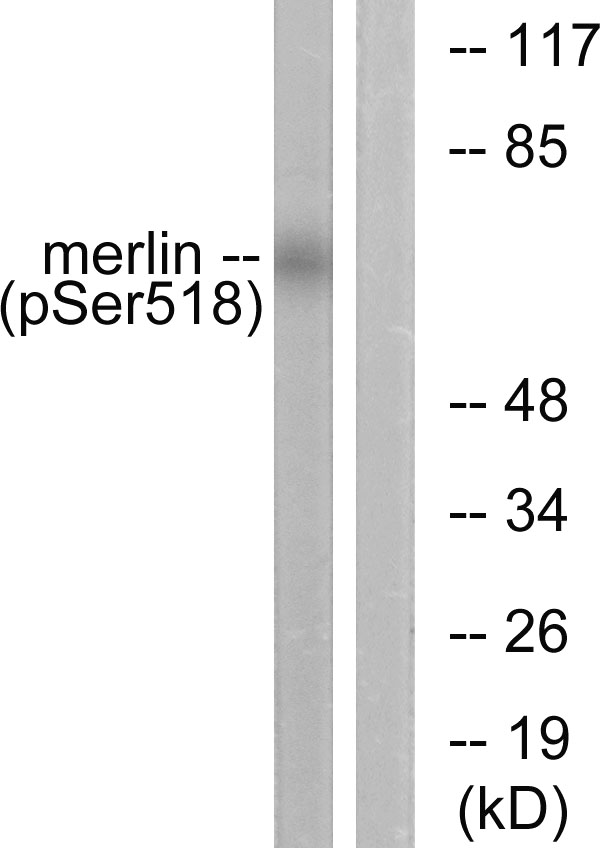 NF2 / Merlin Antibody - Western blot analysis of lysates from HUVEC cells treated with IFN-alpha 1000U/ml 18h, using Merlin (Phospho-Ser518) Antibody. The lane on the right is blocked with the phospho peptide.