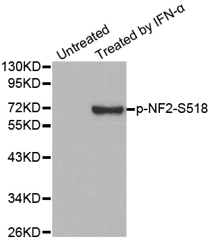 NF2 / Merlin Antibody - Western blot analysis of extracts from HUVEC cells.