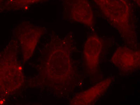 NF2 / Merlin Antibody - Immunofluorescence staining of methanol-fixed Hela cells.