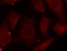 NF2 / Merlin Antibody - Immunofluorescence staining of methanol-fixed Hela cells.