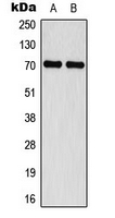 NF2 / Merlin Antibody - Western blot analysis of Merlin (pS518) expression in MCF7 IFN-treated (A); Jurkat IFN-treated (B) whole cell lysates.