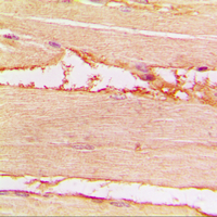 NF2 / Merlin Antibody - Immunohistochemical analysis of Merlin (pS518) staining in human muscle formalin fixed paraffin embedded tissue section. The section was pre-treated using heat mediated antigen retrieval with sodium citrate buffer (pH 6.0). The section was then incubated with the antibody at room temperature and detected using an HRP conjugated compact polymer system. DAB was used as the chromogen. The section was then counterstained with hematoxylin and mounted with DPX.