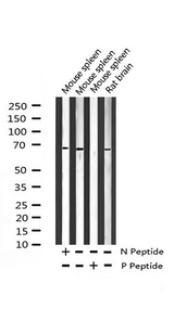 NF2 / Merlin Antibody - Western blot analysis of Phospho-Merlin (Ser518) expression in various lysates