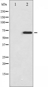 NF2 / Merlin Antibody - Western blot analysis of Merlin phosphorylation expression in IFN-a treated HuvEc whole cells lysates. The lane on the left is treated with the antigen-specific peptide.