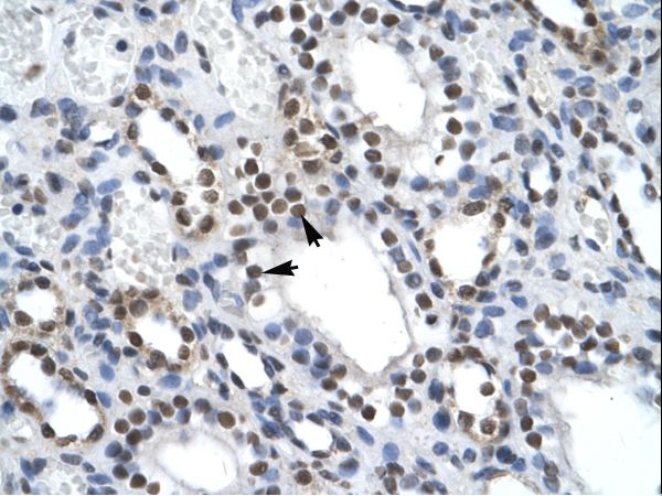 NF45 / ILF2 Antibody - ILF2 antibody ARP35731_T100-NP_004506-ILF2 (interleukin enhancer binding factor 2, 45kDa) Antibody was used in IHC to stain formalin-fixed, paraffin-embedded human kidney.  This image was taken for the unconjugated form of this product. Other forms have not been tested.