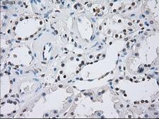 NF45 / ILF2 Antibody - IHC of paraffin-embedded Kidney tissue using anti-ILF2 mouse monoclonal antibody. (Dilution 1:50).
