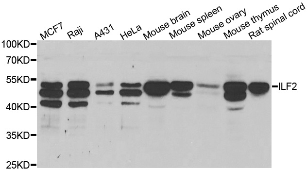 NF45 / ILF2 Antibody - Western blot analysis of extracts of various cell lines.