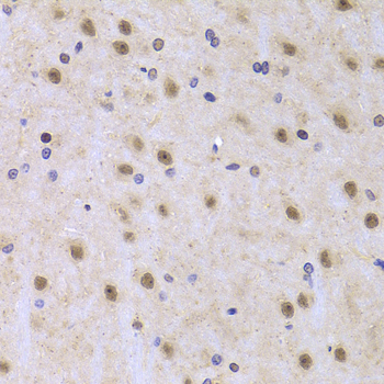NF45 / ILF2 Antibody - Immunohistochemistry of paraffin-embedded Rat brain tissue.