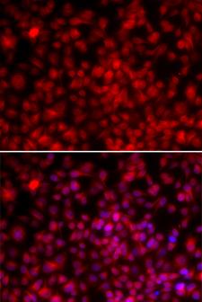 NF45 / ILF2 Antibody - Immunofluorescence analysis of U20S cells.