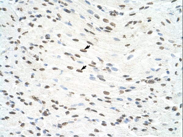NF90 / ILF3 Antibody - ILF3 antibody ARP40522_P050-NP_004507-ILF3(interleukin enhancer binding factor 3, 90kDa) Antibody was used in IHC to stain formalin-fixed, paraffin-embedded human muscle.  This image was taken for the unconjugated form of this product. Other forms have not been tested.