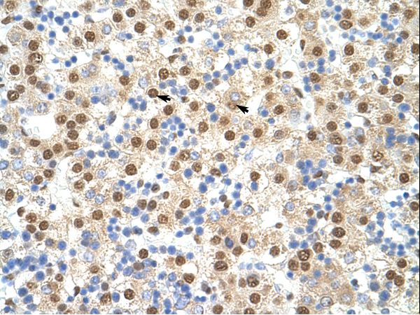 NF90 / ILF3 Antibody - ILF3 antibody ARP40523_P050-NP_004507-ILF3 (interleukin enhancer binding factor 3, 90kDa) Antibody was used in IHC to stain formalin-fixed, paraffin-embedded human liver.  This image was taken for the unconjugated form of this product. Other forms have not been tested.