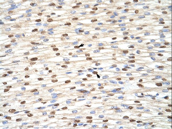 NF90 / ILF3 Antibody - ILF3 antibody ARP40523_P050-NP_004507-ILF3 (interleukin enhancer binding factor 3, 90kDa) Antibody was used in IHC to stain formalin-fixed, paraffin-embedded human heart.  This image was taken for the unconjugated form of this product. Other forms have not been tested.