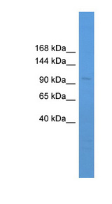 NF90 / ILF3 Antibody - ILF3 antibody Western blot of Mouse Small Intestine lysate. This image was taken for the unconjugated form of this product. Other forms have not been tested.