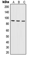 NF90 / ILF3 Antibody - Western blot analysis of ILF3 expression in A431 (A); Raji (B); K562 (C) whole cell lysates.