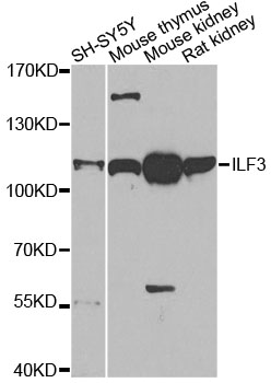 NF90 / ILF3 Antibody - Western blot analysis of extracts of various cell lines, using ILF3 antibody at 1:1000 dilution. The secondary antibody used was an HRP Goat Anti-Rabbit IgG (H+L) at 1:10000 dilution. Lysates were loaded 25ug per lane and 3% nonfat dry milk in TBST was used for blocking. An ECL Kit was used for detection and the exposure time was 90s.
