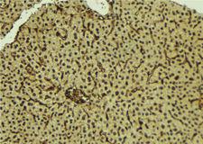 NF90 / ILF3 Antibody - 1:100 staining mouse liver tissue by IHC-P. The sample was formaldehyde fixed and a heat mediated antigen retrieval step in citrate buffer was performed. The sample was then blocked and incubated with the antibody for 1.5 hours at 22°C. An HRP conjugated goat anti-rabbit antibody was used as the secondary.