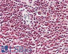 NF90 / ILF3 Antibody - Anti-NF90 / ILF3 antibody IHC of human spleen. Immunohistochemistry of formalin-fixed, paraffin-embedded tissue after heat-induced antigen retrieval. Antibody dilution 5-10 ug/ml. This image was taken for the unconjugated form of this product. Other forms have not been tested.