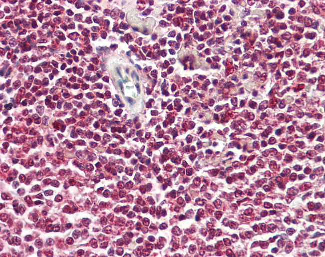 NF90 / ILF3 Antibody - Anti-NF90 / ILF3 antibody IHC of human spleen. Immunohistochemistry of formalin-fixed, paraffin-embedded tissue after heat-induced antigen retrieval. Antibody dilution 5-10 ug/ml. This image was taken for the unconjugated form of this product. Other forms have not been tested.