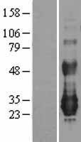 NFAM1 Protein - Western validation with an anti-DDK antibody * L: Control HEK293 lysate R: Over-expression lysate