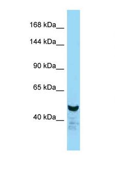 NFAT1 / NFATC2 Antibody - NFATC2 antibody Western blot of Mouse Liver lysate. Antibody concentration 1 ug/ml.  This image was taken for the unconjugated form of this product. Other forms have not been tested.