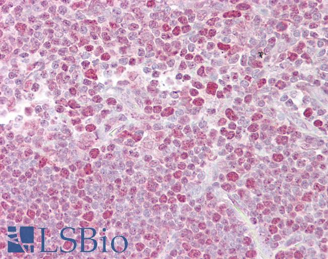 NFAT1 / NFATC2 Antibody - Anti-NFATC2 antibody IHC of human thymus. Immunohistochemistry of formalin-fixed, paraffin-embedded tissue after heat-induced antigen retrieval. Antibody concentration 5 ug/ml.  This image was taken for the unconjugated form of this product. Other forms have not been tested.
