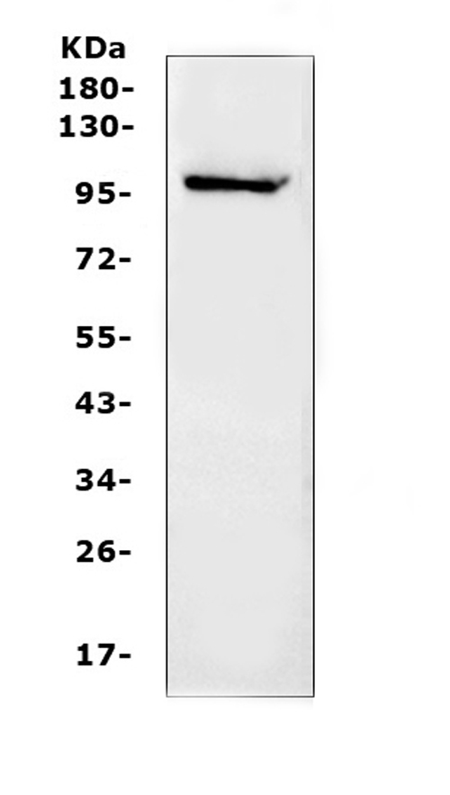 NFAT1 / NFATC2 Antibody - Western blot analysis of NFAT1 using anti-NFAT1 antibody. Electrophoresis was performed on a 5-20% SDS-PAGE gel at 70V (Stacking gel) / 90V (Resolving gel) for 2-3 hours. The sample well of each lane was loaded with 50ug of sample under reducing conditions. Lane 1: human K562 whole cell lysates. After Electrophoresis, proteins were transferred to a Nitrocellulose membrane at 150mA for 50-90 minutes. Blocked the membrane with 5% Non-fat Milk/ TBS for 1.5 hour at RT. The membrane was incubated with rabbit anti-NFAT1 antigen affinity purified polyclonal antibody at 0.5 ug/mL overnight at 4?, then washed with TBS-0.1% Tween 3 times with 5 minutes each and probed with a goat anti-rabbit IgG-HRP secondary antibody at a dilution of 1:10000 for 1.5 hour at RT. The signal is developed using an Enhanced Chemiluminescent detection (ECL) kit with Tanon 5200 system. A specific band was detected for NFAT1 at approximately 100KD. The expected band size for NFAT1 is at 100KD.