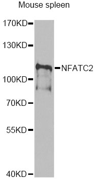 NFAT1 / NFATC2 Antibody - Western blot analysis of extracts of mouse spleen, using NFATC2 antibody at 1:1000 dilution. The secondary antibody used was an HRP Goat Anti-Rabbit IgG (H+L) at 1:10000 dilution. Lysates were loaded 25ug per lane and 3% nonfat dry milk in TBST was used for blocking. An ECL Kit was used for detection and the exposure time was 5s.