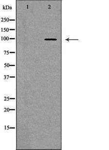 NFAT1 / NFATC2 Antibody - Western blot analysis of extracts of mouse fetal brain tissue using NFATC2 antibody. The lane on the left is treated with the antigen-specific peptide.