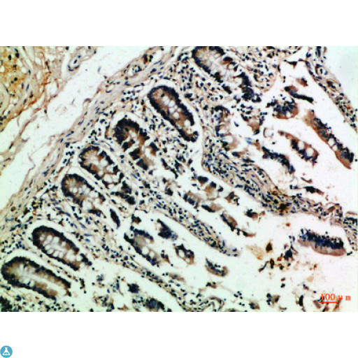 NFAT1 / NFATC2 Antibody - Immunohistochemical analysis of paraffin-embedded human-colon, antibody was diluted at 1:100.