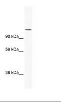 NFAT1 / NFATC2 Antibody - SP2/0 Cell Lysate.  This image was taken for the unconjugated form of this product. Other forms have not been tested.