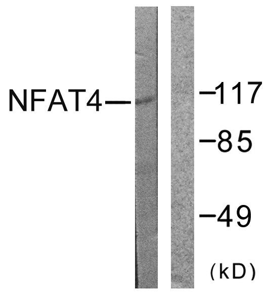 NFAT4 / NFATC3 Antibody - Western blot analysis of lysates from HeLa cells, treated with Ca+ 40nM 30', using NFAT4 Antibody. The lane on the right is blocked with the synthesized peptide.