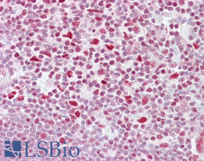 NFAT4 / NFATC3 Antibody - Anti-NFATC3 antibody IHC of human thymus. Immunohistochemistry of formalin-fixed, paraffin-embedded tissue after heat-induced antigen retrieval. Antibody concentration 5 ug/ml.  This image was taken for the unconjugated form of this product. Other forms have not been tested.