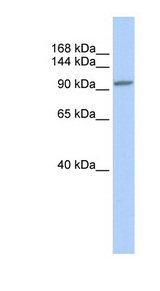 NFAT4 / NFATC3 Antibody - NFATC3 antibody Western blot of HeLa lysate. This image was taken for the unconjugated form of this product. Other forms have not been tested.