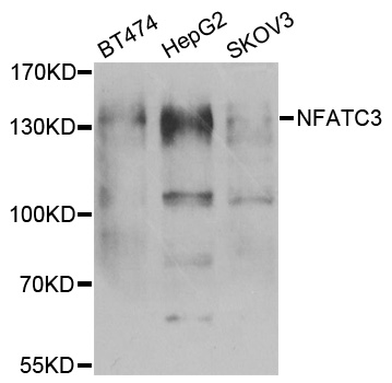 NFAT4 / NFATC3 Antibody - Western blot analysis of extracts of various cell lines.