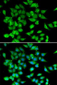 NFAT4 / NFATC3 Antibody - Immunofluorescence analysis of HeLa cells.