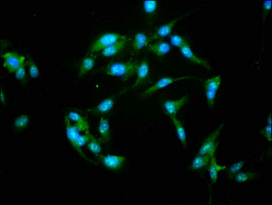 NFAT4 / NFATC3 Antibody - Immunofluorescence staining of Hela cells with NFATC3 Antibody at 1:155, counter-stained with DAPI. The cells were fixed in 4% formaldehyde, permeabilized using 0.2% Triton X-100 and blocked in 10% normal Goat Serum. The cells were then incubated with the antibody overnight at 4°C. The secondary antibody was Alexa Fluor 488-congugated AffiniPure Goat Anti-Rabbit IgG(H+L).