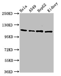 NFAT4 / NFATC3 Antibody - Western Blot Positive WB detected in: Hela whole cell lysate, A549 whole cell lysate, HepG2 whole cell lysate, Rat kidney tissue All lanes: NFATC3 antibody at 4.6µg/ml Secondary Goat polyclonal to rabbit IgG at 1/50000 dilution Predicted band size: 116, 113, 78, 81 kDa Observed band size: 116 kDa